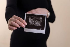 pregnant-woman-holding-up-ultrasound-photo
