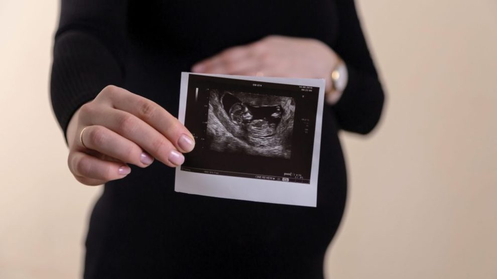 pregnant-woman-holding-up-ultrasound-photo