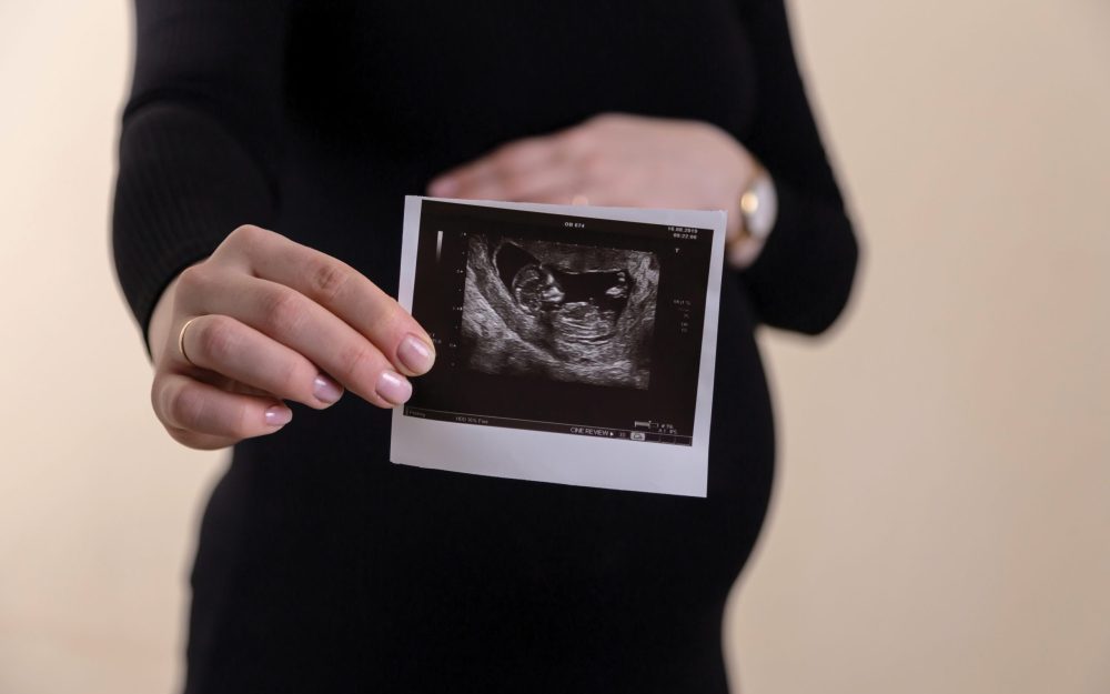 pregnant-woman-holding-up-ultrasound-photo